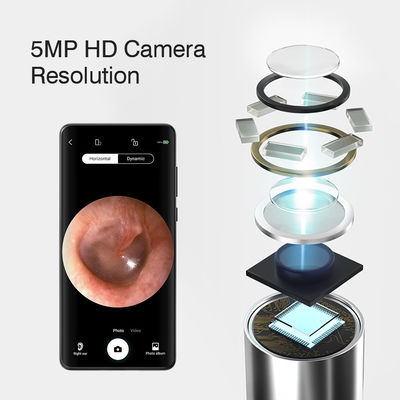 3.9mm HD Digital WiFi Ear Otoscope z funkcją kierunkową AI i połączeniem WiFi